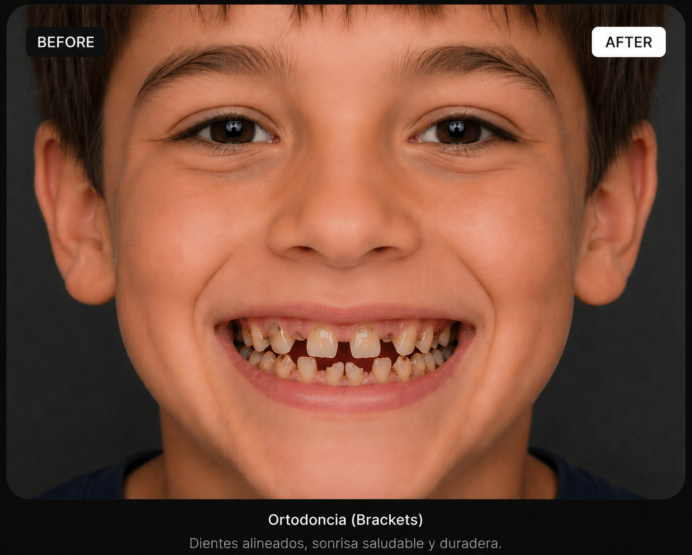 Antes – Antes y después — Mateo, 12 años